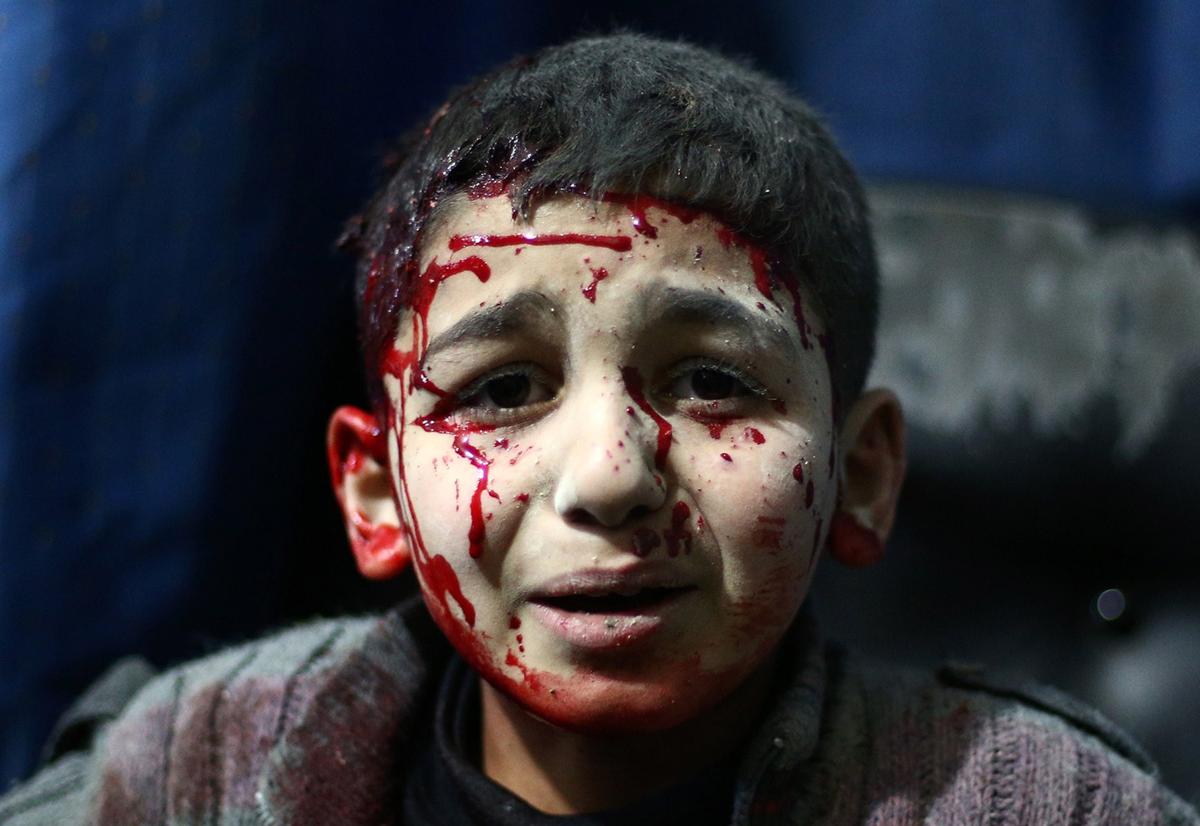 Crian?as de guerra.Foto:(ABD DOUMANY / AFP / Getty Images)